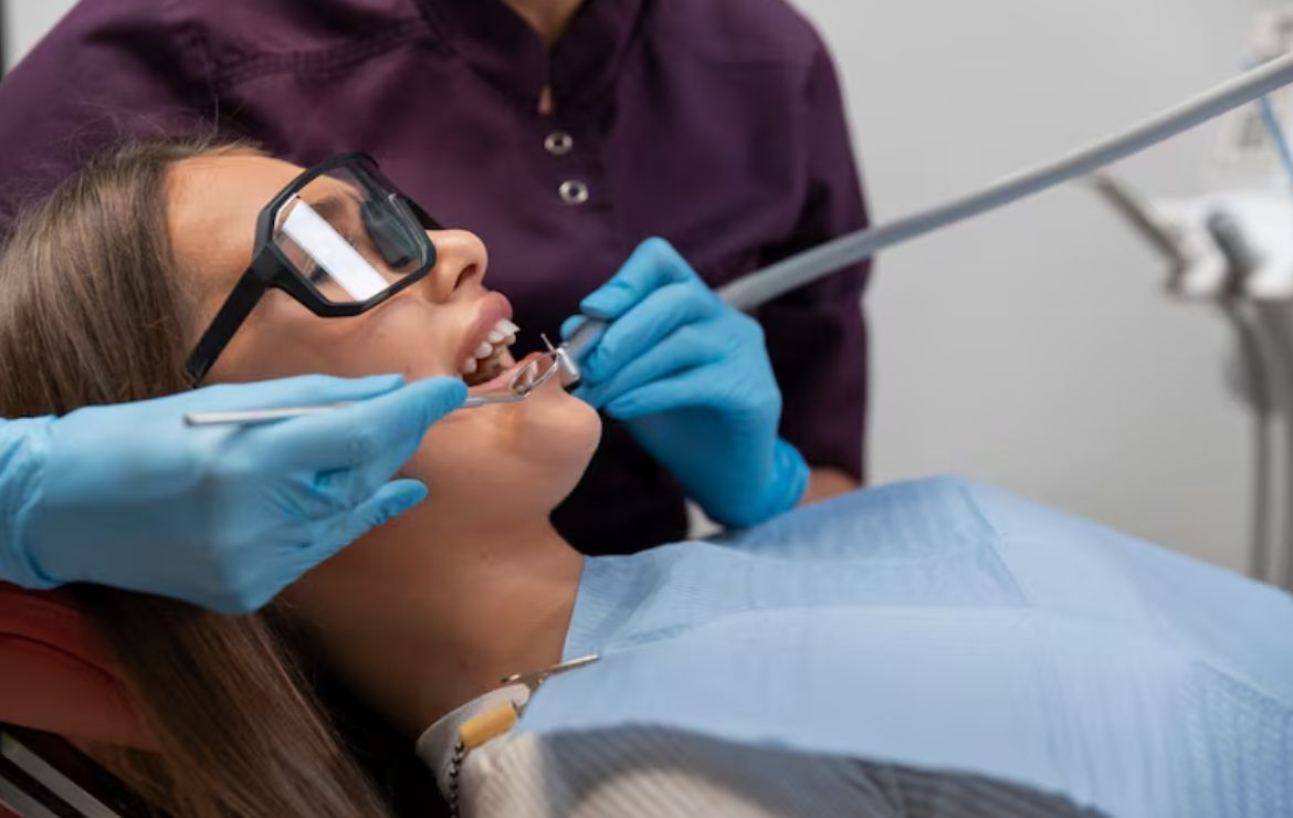 Dental Veneers vs. dental Bonding