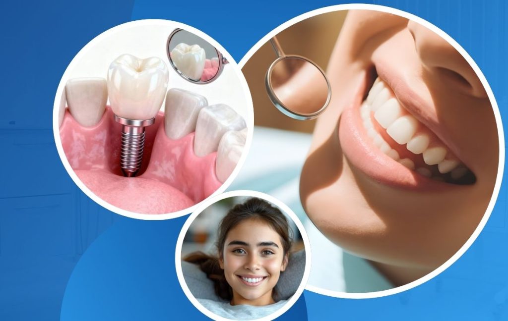 Top Signs You May Need a Dental Crown