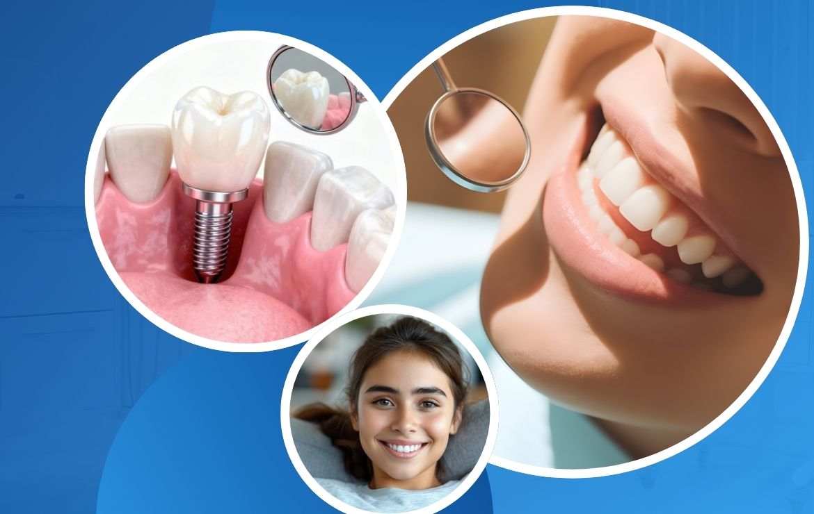 Top Signs You May Need a Dental Crown