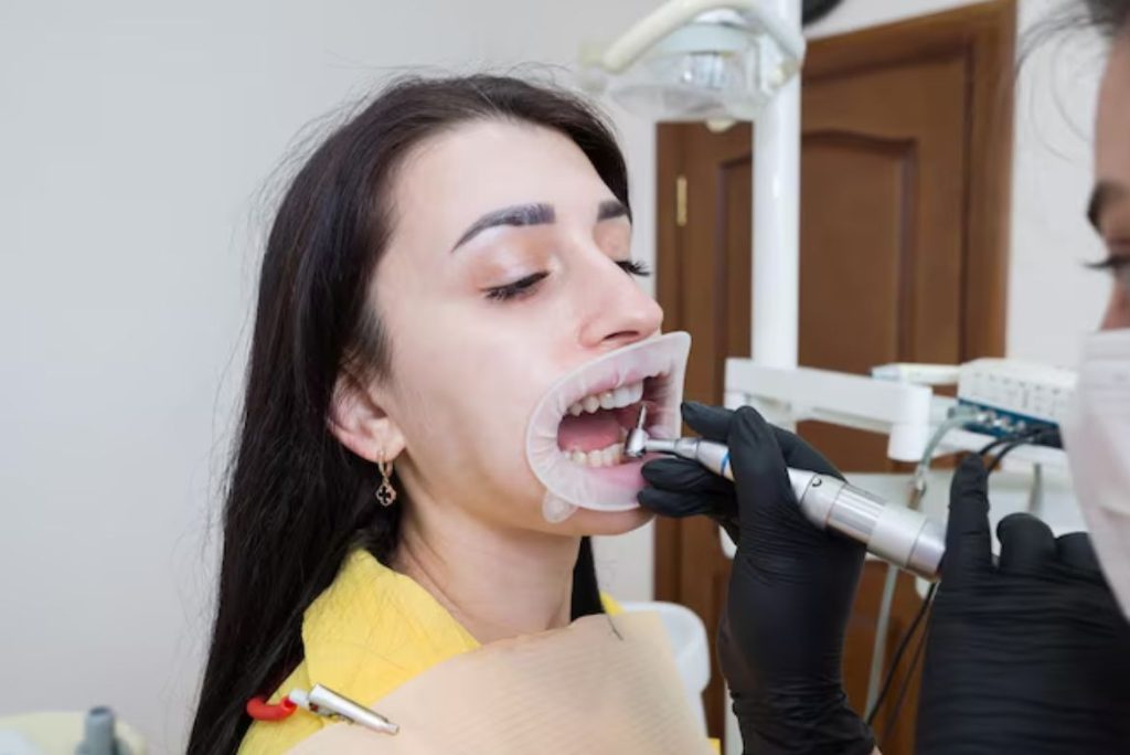 gum disease in Kingston