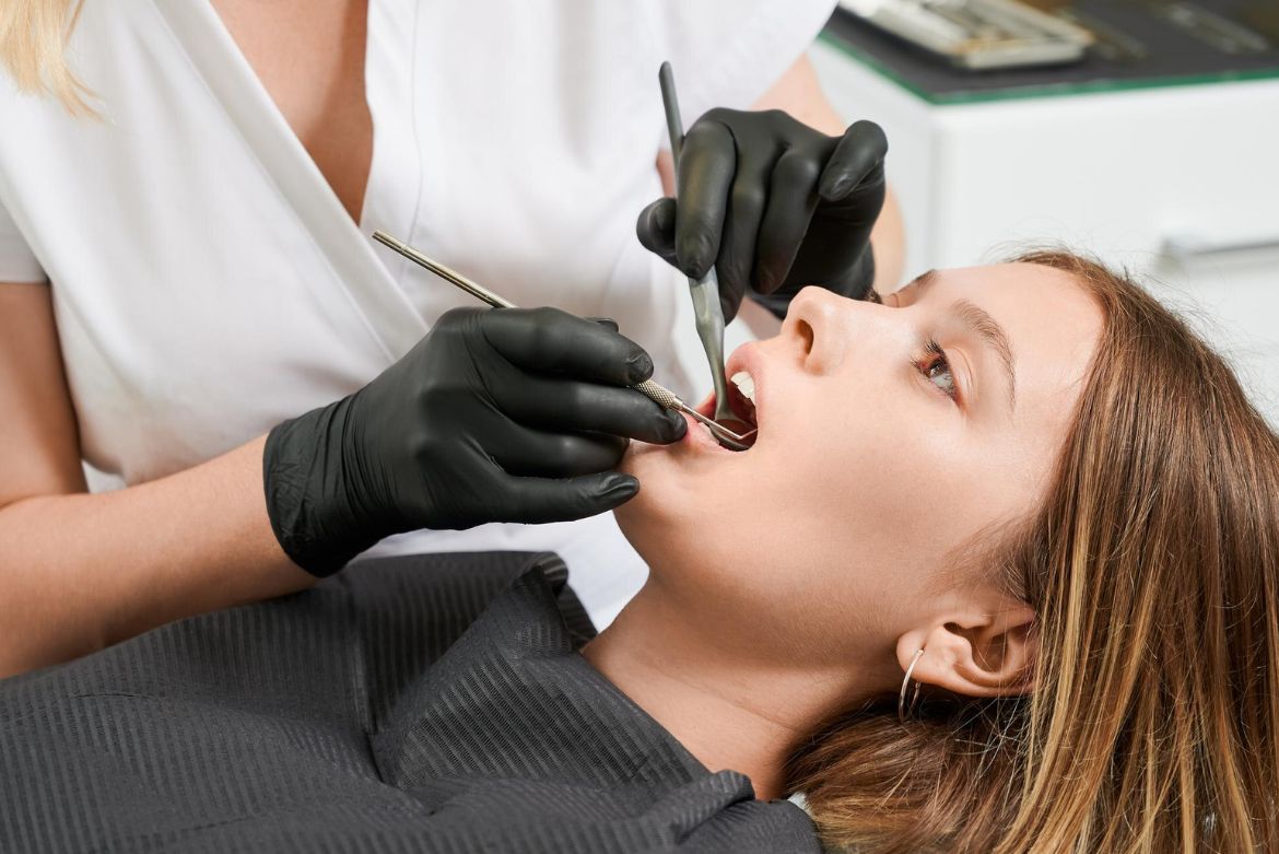 Dental Fillings Services in Kingston